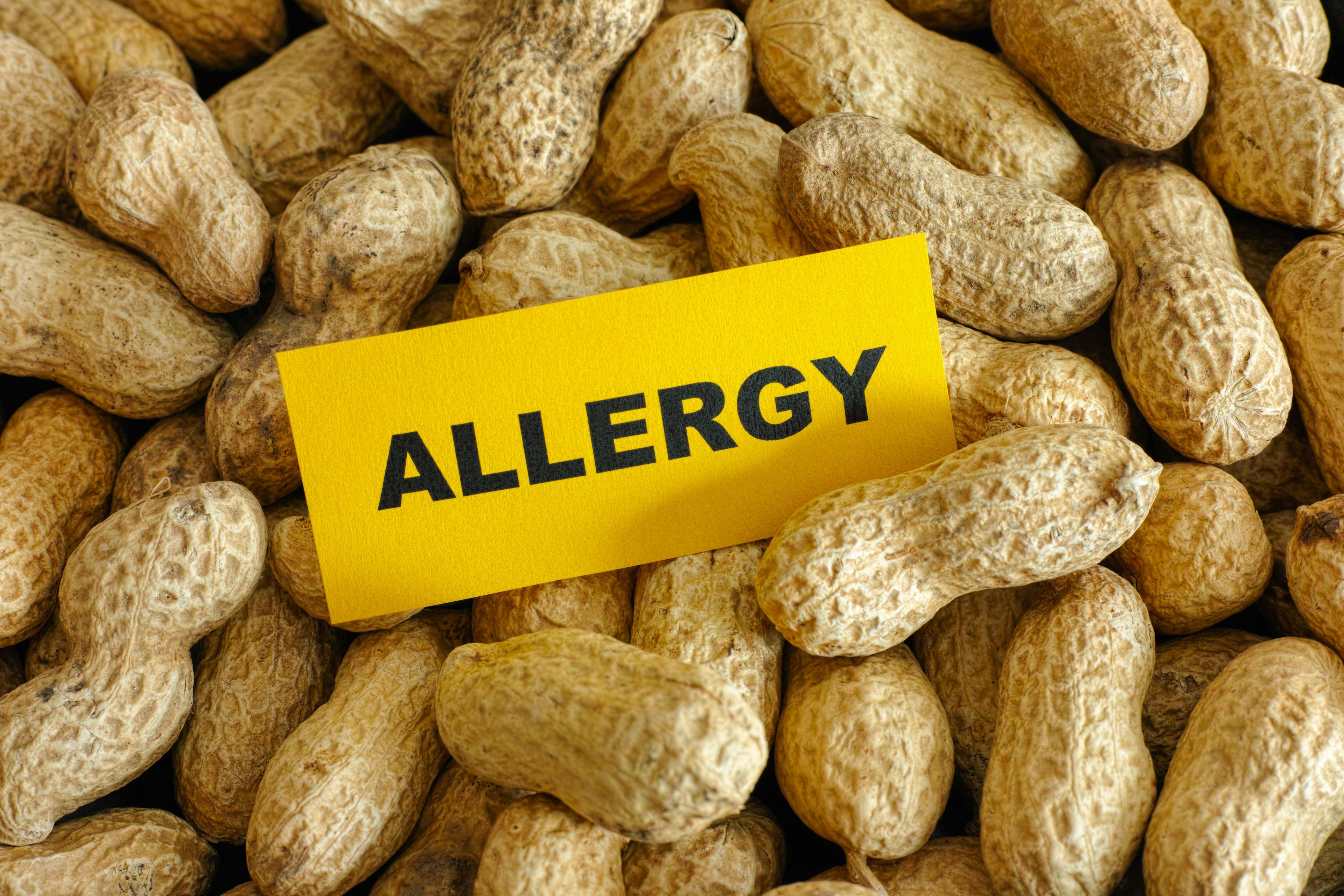 Peanut allergy | Image Credit: Stepan Popov - stock.adobe.com