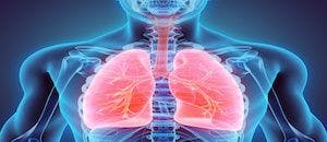 COPD: Should a Clinician Treat or Refer? 