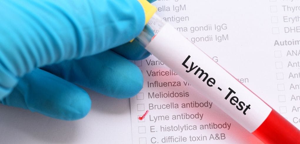 Lyme Disease Continues to Be Top-Of-Mind for Clinicians Based on Past Summer Data
